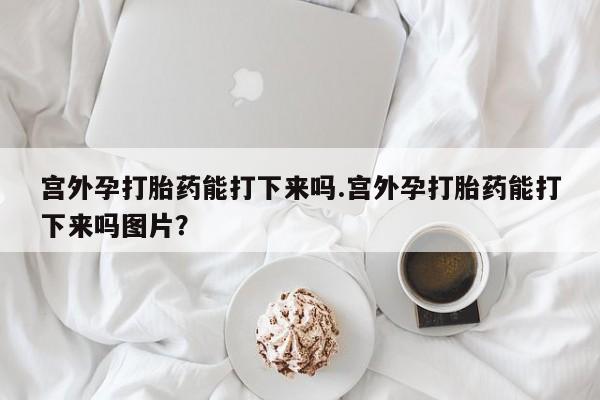 私人卖打胎药联系方式宫外孕打胎药能打下来吗.宫外孕打胎药能打下来吗图片？